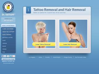 Tattoo Removal